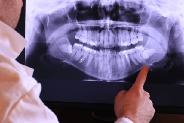 Best 24-Hour Emergency Dentist in Saranap, CA