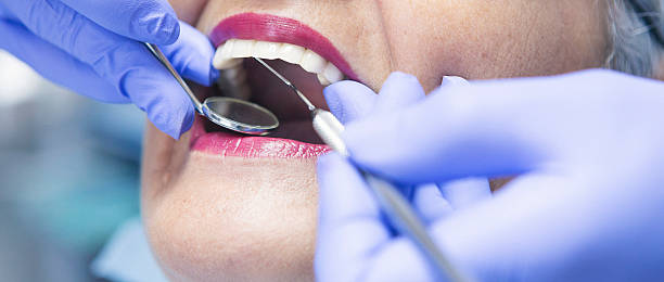 Best After-Hours Dental Trauma Care in Saranap, CA